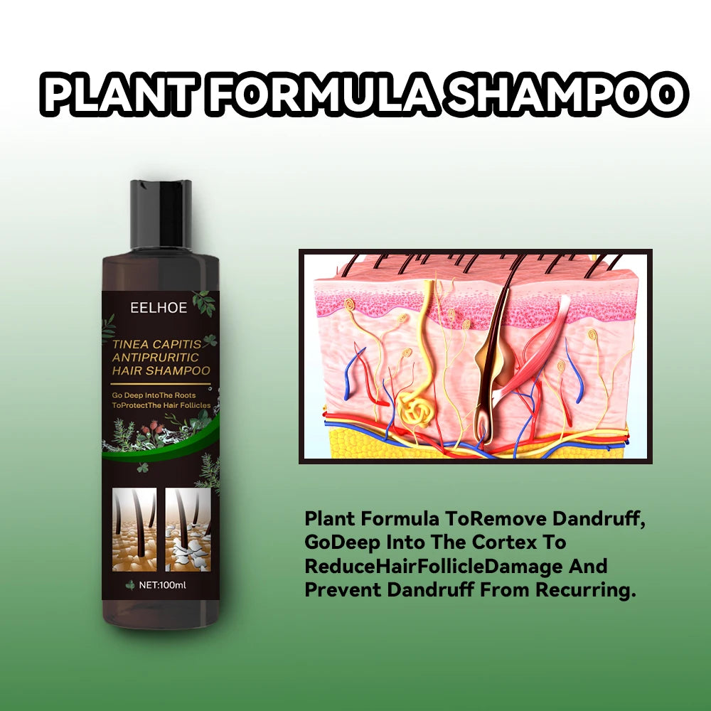 EELHOE champú de Limpieza del cabello anticaspa eliminar ácaros aliviar la picazón Control de aceite limpieza del cuero cabelludo champú refrescante para el cabello