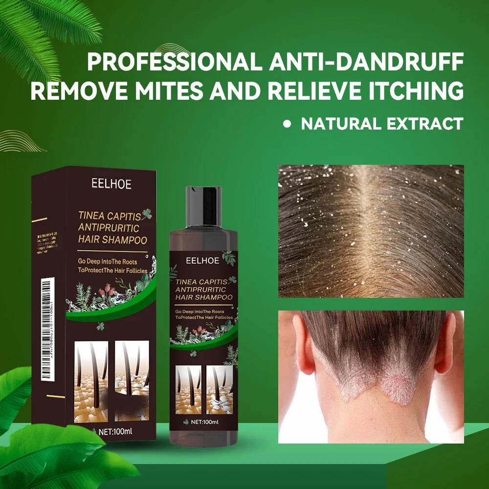 EELHOE champú de Limpieza del cabello anticaspa eliminar ácaros aliviar la picazón Control de aceite limpieza del cuero cabelludo champú refrescante para el cabello