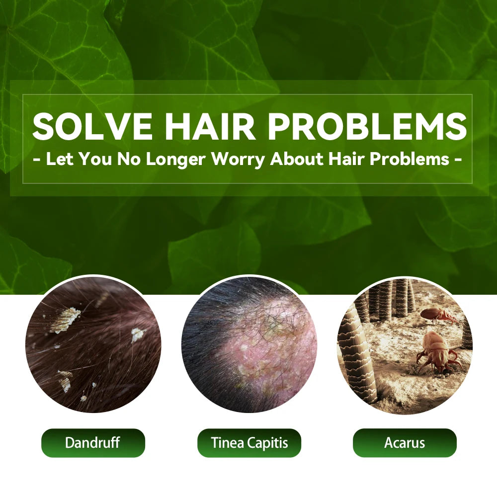 EELHOE champú de Limpieza del cabello anticaspa eliminar ácaros aliviar la picazón Control de aceite limpieza del cuero cabelludo champú refrescante para el cabello
