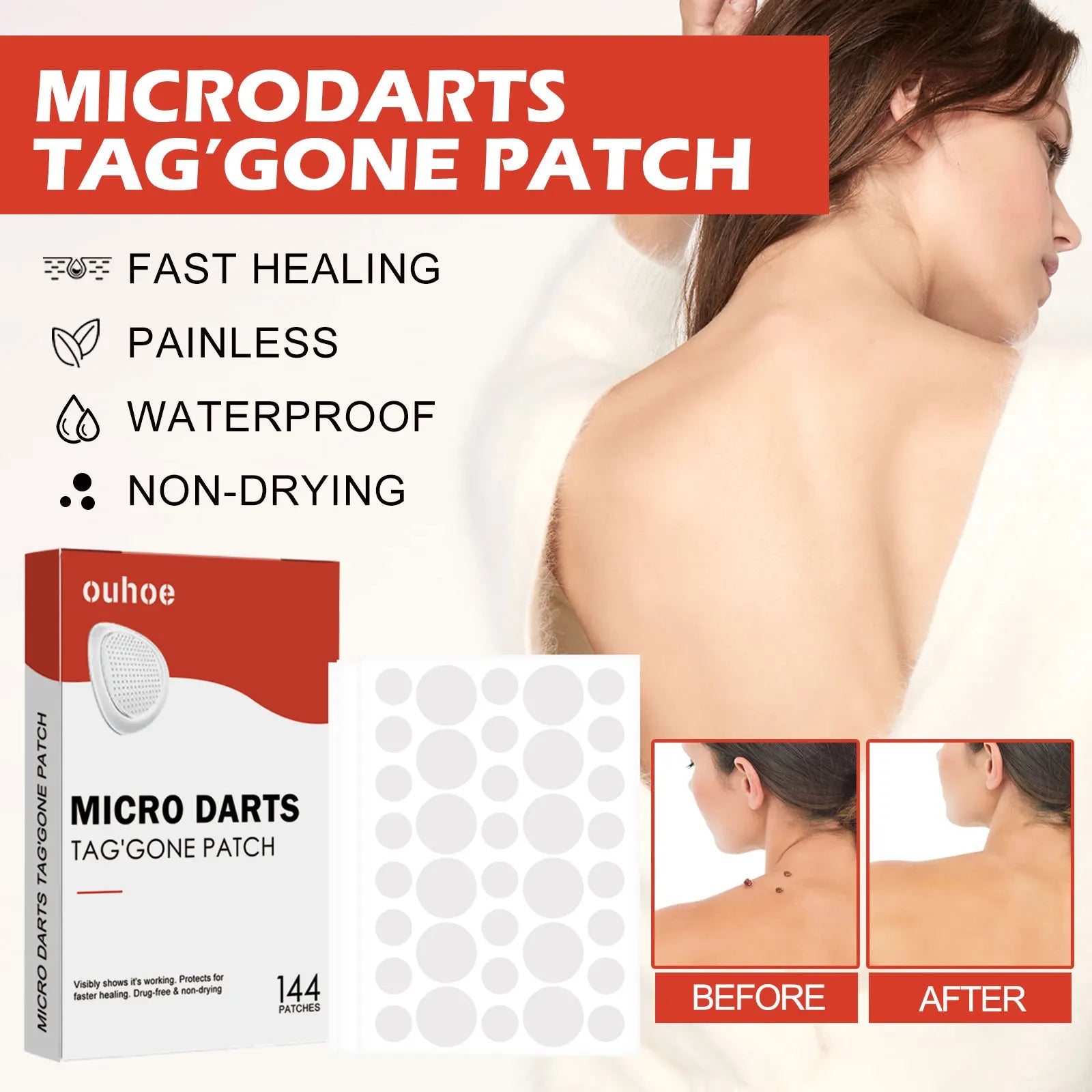 OUHOE Body Patches Skin Clean Acne Pimple Moles Gram Wart Corns Spot Patch