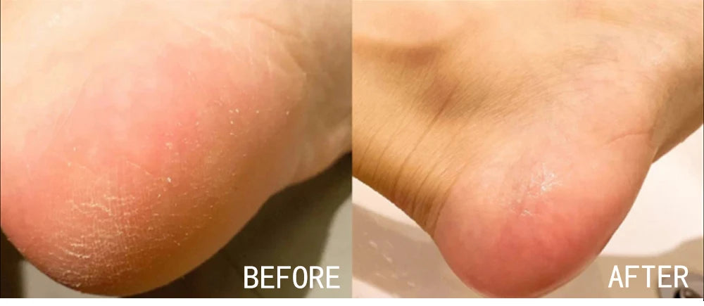 AILKE blanqueamiento eliminar manchas negras loción para el cuidado de la piel Facial crema hidratante glutatión corporal vitamina C piel negra cara nuevo conjunto