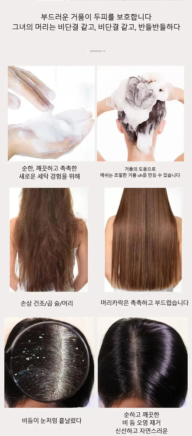 Herbal Polygonum Multiflorum Champú Control de aceite, Control de caspa, Champú para aliviar la picazón para hombres y mujeres
