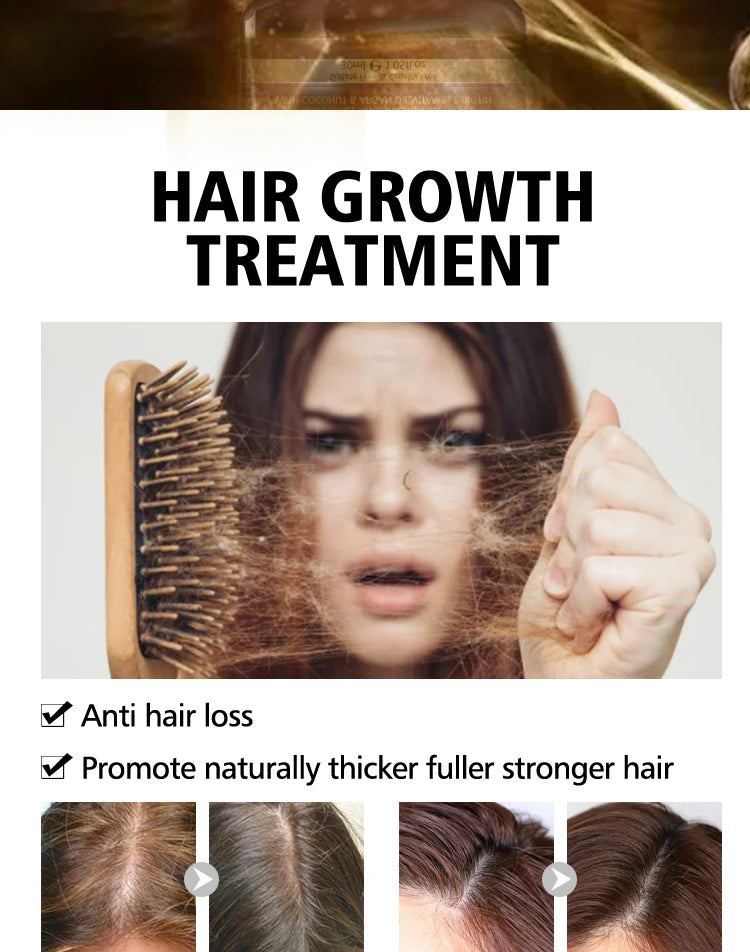 PURC Biotina champú acondicionador para el cabello para hombres y mujeres limpieza del cuero cabelludo raíz del cabello nutre aceite suavizante mascarilla para el cabello conjunto de productos para el cuidado