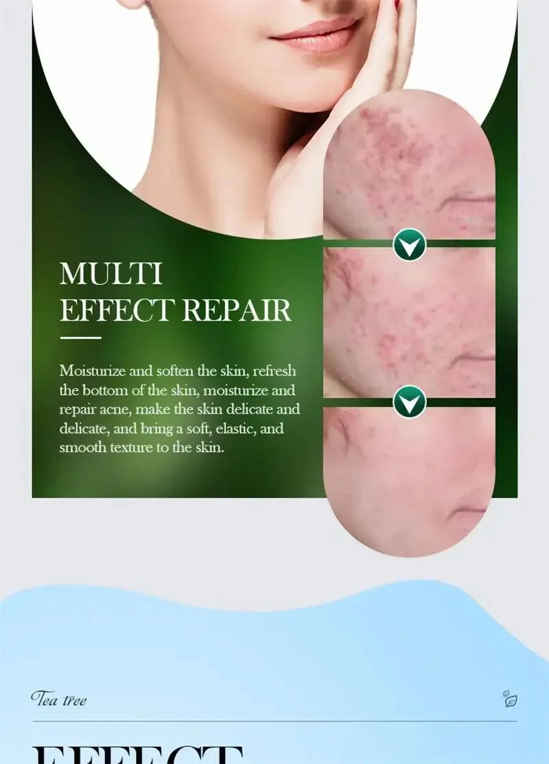 Crema para eliminar el acné del árbol de té, Control de aceite hidratante suave para el rostro, Gel Facial para eliminar el acné, espinillas, belleza y salud