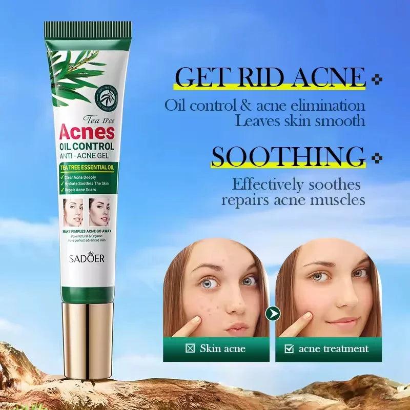 Crema para eliminar el acné del árbol de té, Control de aceite hidratante suave para el rostro, Gel Facial para eliminar el acné, espinillas, belleza y salud