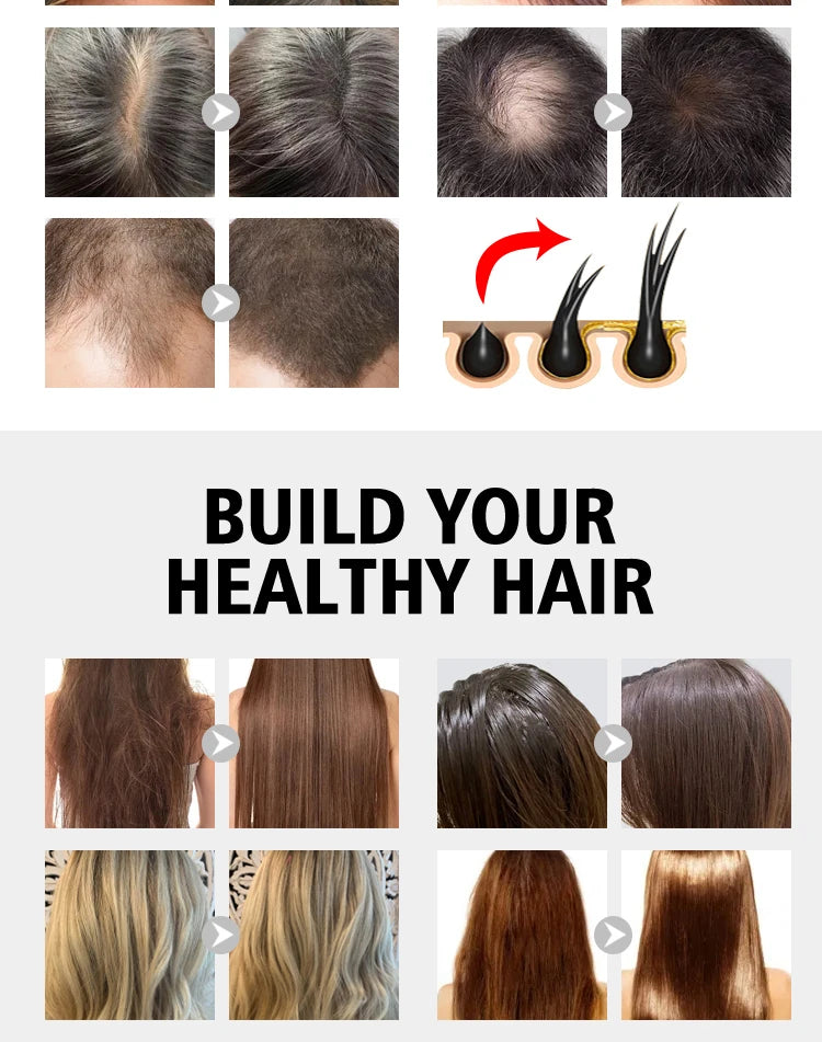 PURC Biotina champú acondicionador para el cabello para hombres y mujeres limpieza del cuero cabelludo raíz del cabello nutre aceite suavizante mascarilla para el cabello conjunto de productos para el cuidado