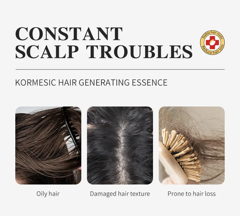 Suero para el Crecimiento del Cabello, Aceite Anticaída y Regenerador, Previene la Calvicie, Repara el Daño, Masajea el Cuero Cabelludo, Hidrata y Nutre, Cuidado Capilar
