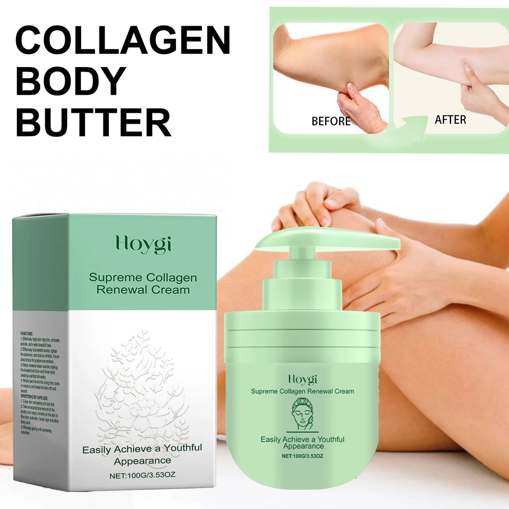 Loción corporal de colágeno Hoygi para piel seca, crema reafirmante hidratante con niacinamida, piel suave, hidratante diario para mujeres, 100g