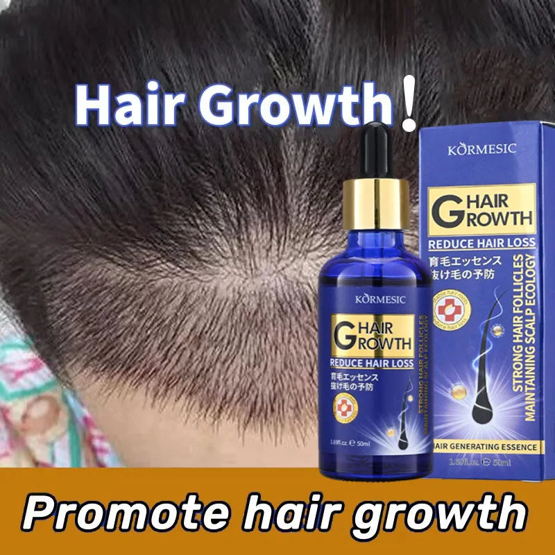 Suero para el Crecimiento del Cabello, Aceite Anticaída y Regenerador, Previene la Calvicie, Repara el Daño, Masajea el Cuero Cabelludo, Hidrata y Nutre, Cuidado Capilar