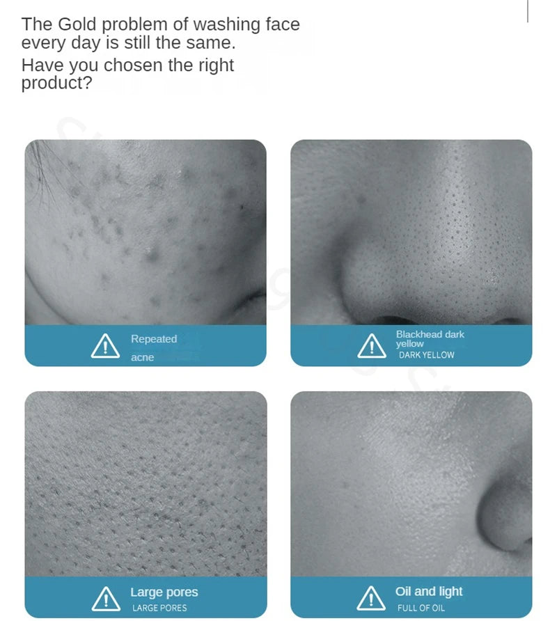 Limpiador Facial de aminoácidos, limpieza profunda, limpiador hidratante con Control de aceite, Gel de limpieza suave, productos de lavado de cara para el cuidado de la piel