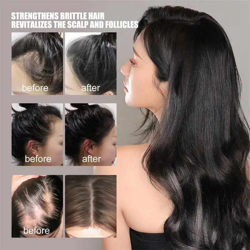 Suero para el Crecimiento del Cabello, Aceite Anticaída y Regenerador, Previene la Calvicie, Repara el Daño, Masajea el Cuero Cabelludo, Hidrata y Nutre, Cuidado Capilar