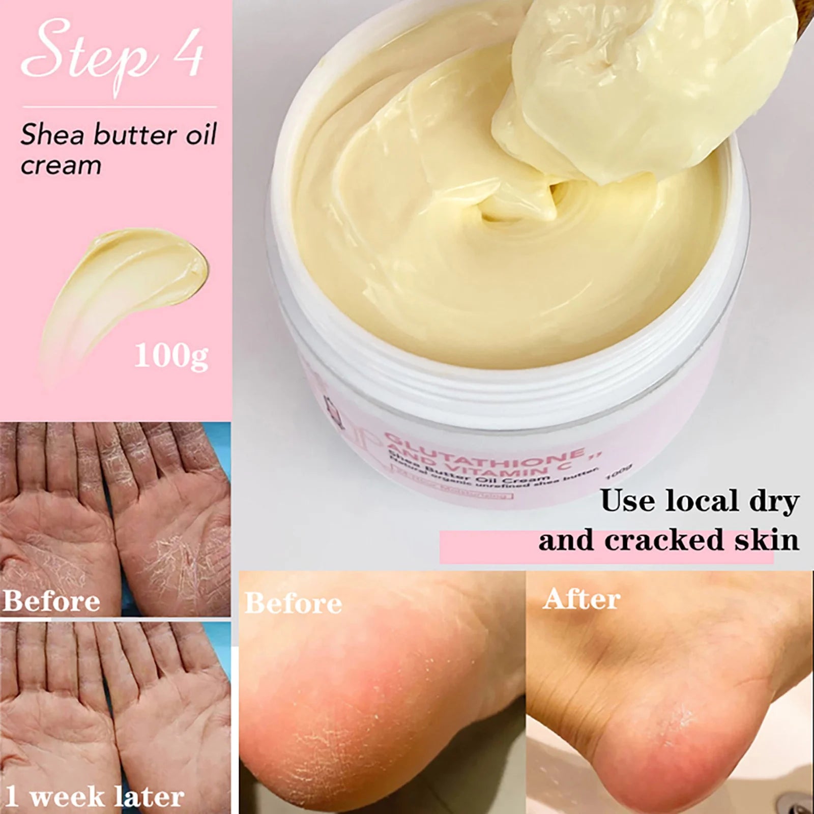 AILKE blanqueamiento eliminar manchas negras loción para el cuidado de la piel Facial crema hidratante glutatión corporal vitamina C piel negra cara nuevo conjunto