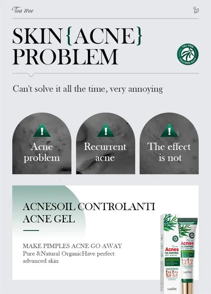 Crema para eliminar el acné del árbol de té, Control de aceite hidratante suave para el rostro, Gel Facial para eliminar el acné, espinillas, belleza y salud