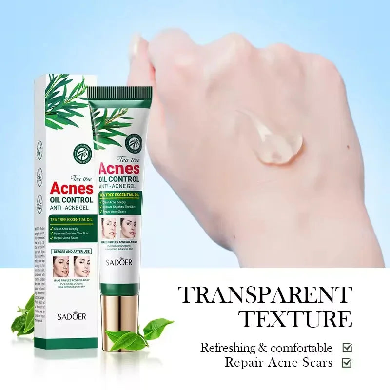 Crema para eliminar el acné del árbol de té, Control de aceite hidratante suave para el rostro, Gel Facial para eliminar el acné, espinillas, belleza y salud