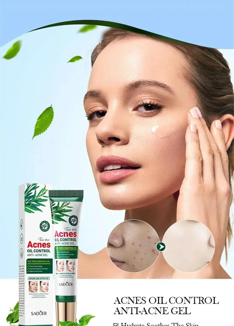 Crema para eliminar el acné del árbol de té, Control de aceite hidratante suave para el rostro, Gel Facial para eliminar el acné, espinillas, belleza y salud