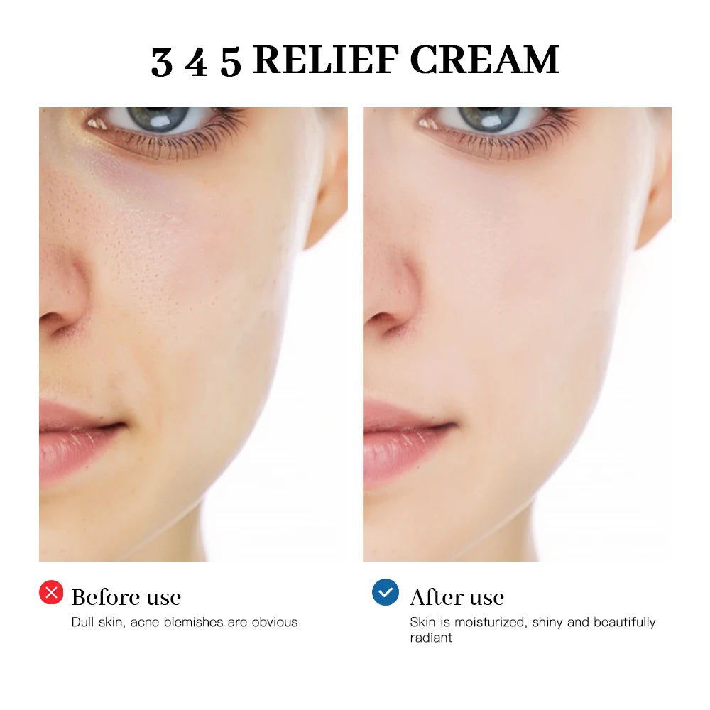 Crema de alivio 345, solución integral para problemas de la piel, antiazúcar y antioxidante, brillo de la piel, mejora las marcas de acné, humedad