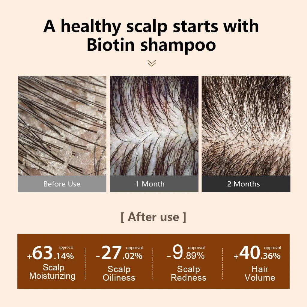 PURC Biotina champú acondicionador para el cabello para hombres y mujeres limpieza del cuero cabelludo raíz del cabello nutre aceite suavizante mascarilla para el cabello conjunto de productos para el cuidado